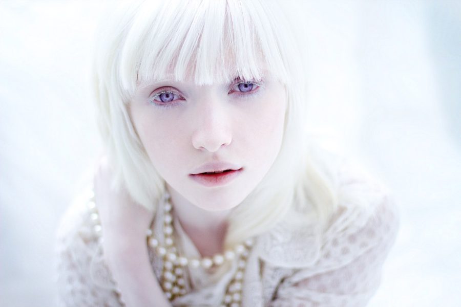 albino people with purple eyes